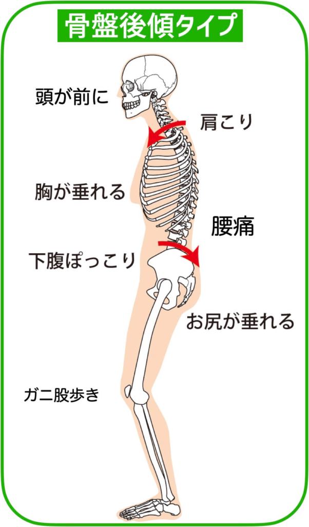 武蔵小金井 腰痛 整体