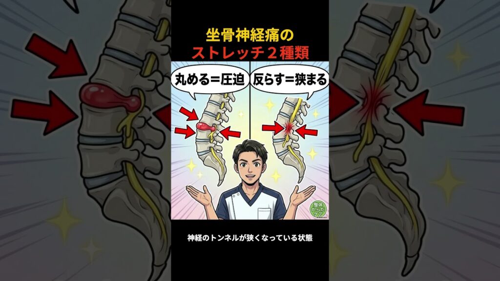 坐骨神経痛のストレッチはどっち